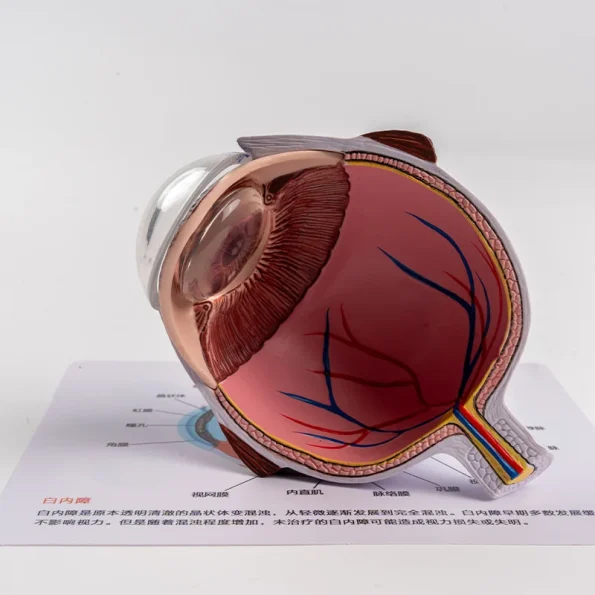Pathological Eye Model with Interchangeable Lenses for Cataract Demonstration