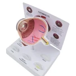 Pathological Eye Model with Interchangeable Lenses for Cataract Demonstration