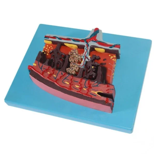 Placenta Tissue Anatomy Model Human Placenta Cross Section Structure Demonstration Model for Obstetrics Gynecology Teaching