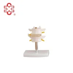 Plastic Lumbar Vertebrae Set Model (2 Pcs)