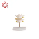Plastic Lumbar Vertebrae Set Model (2 Pcs)