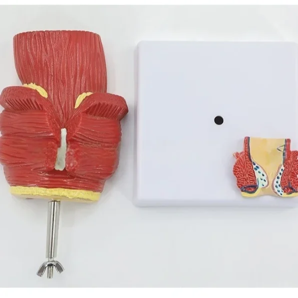 Proctology Colorectal Education Model Rectal Hemorrhoid Anatomy with Internal External Hemorrhoids for Medical School Training