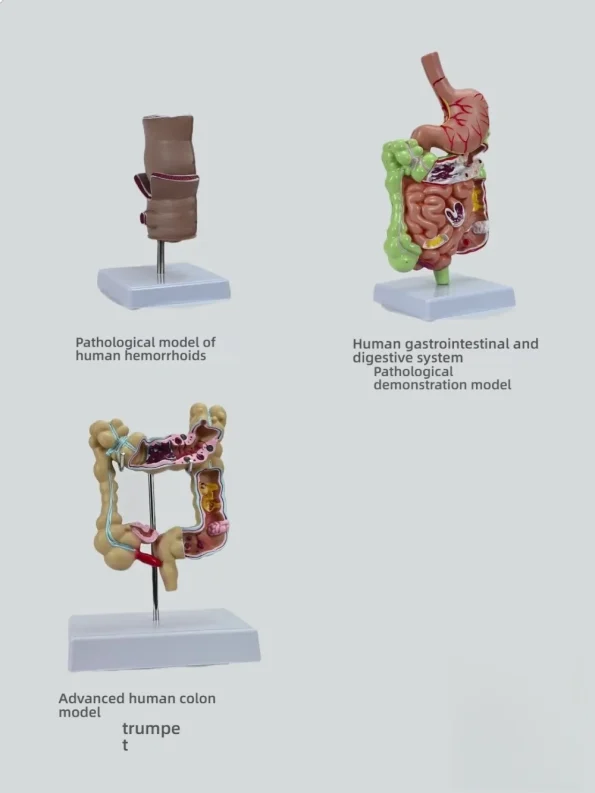 Proctology Colorectal Education Model Rectal Hemorrhoid Anatomy with Internal External Hemorrhoids for Medical School Training