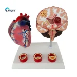 Proportion Hypertension Demonstration Model for Humans Educational Equipment Related to Heart Thrombus Brain Diseases