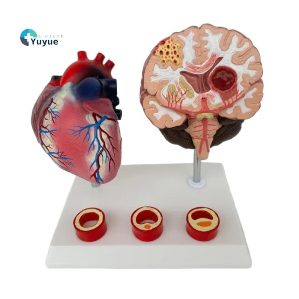 Proportion Hypertension Demonstration Model for Humans Educational Equipment Related to Heart Thrombus Brain Diseases