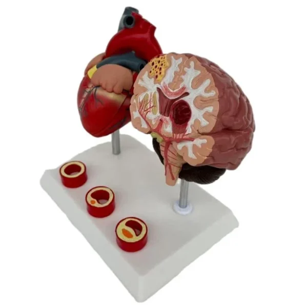 Proportion Hypertension Demonstration Model for Humans Educational Equipment Related to Heart Thrombus Brain Diseases