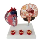 Proportion Hypertension Demonstration Model for Humans Educational Equipment Related to Heart Thrombus Brain Diseases
