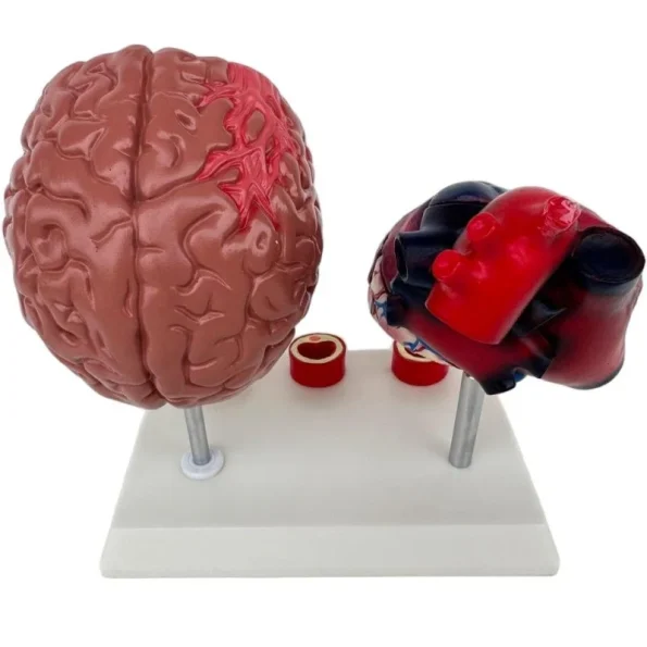 Proportion Hypertension Demonstration Model for Humans Educational Equipment Related to Heart Thrombus Brain Diseases