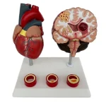 Proportion Hypertension Demonstration Model for Humans Educational Equipment Related to Heart Thrombus Brain Diseases
