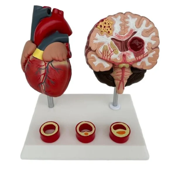 Proportion Hypertension Demonstration Model for Humans Educational Equipment Related to Heart Thrombus Brain Diseases
