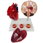 Proportion Hypertension Demonstration Model for Humans Educational Equipment Related to Heart Thrombus Brain Diseases