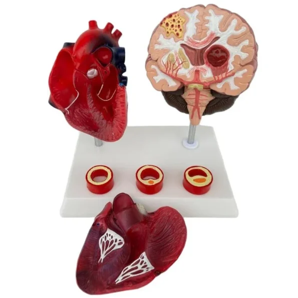 Proportion Hypertension Demonstration Model for Humans Educational Equipment Related to Heart Thrombus Brain Diseases