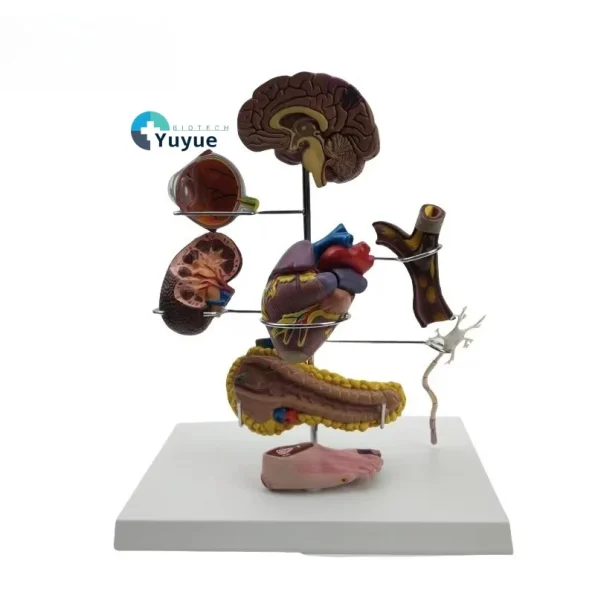 PVC Diabetes Anatomical Organ Model Medical Teaching Tool for Hospitals and Educational Use in Medical Science