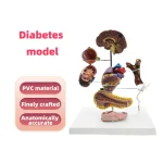 PVC Diabetes Anatomical Organ Model Medical Teaching Tool for Hospitals and Educational Use in Medical Science