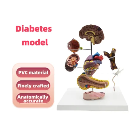 PVC Diabetes Anatomical Organ Model Medical Teaching Tool for Hospitals and Educational Use in Medical Science