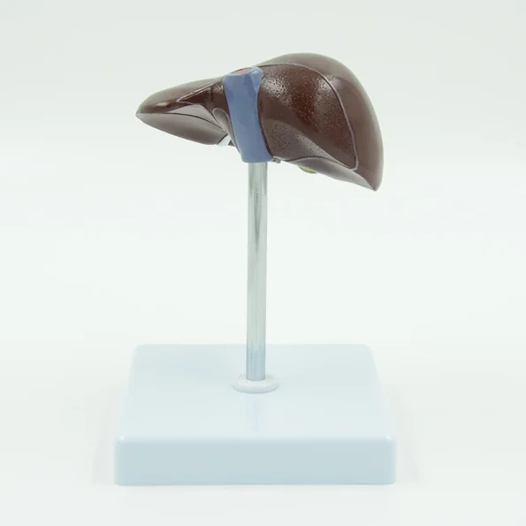 PVC Pathological Liver Model Visualize Common Hepatic & Gallbladder Disorders
