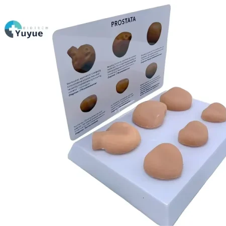 PVC Prostate Mass Anatomical Model Tactile Learning Tool for Medical Education