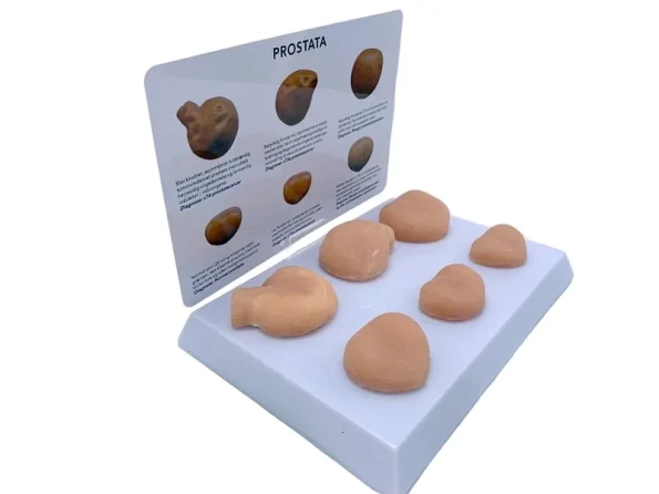PVC Prostate Mass Anatomical Model Tactile Learning Tool for Medical Education