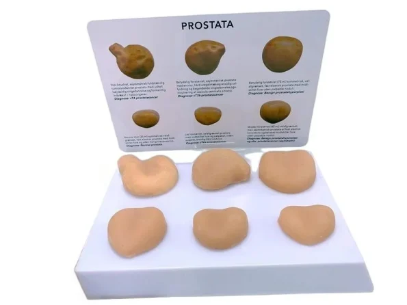 PVC Prostate Mass Anatomical Model Tactile Learning Tool for Medical Education