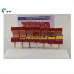 Realistic Artery Atherosclerosis Model 7-Segment | Lab & Medical Training Equipment