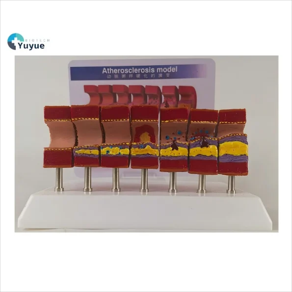 Realistic Artery Atherosclerosis Model 7-Segment | Lab & Medical Training Equipment