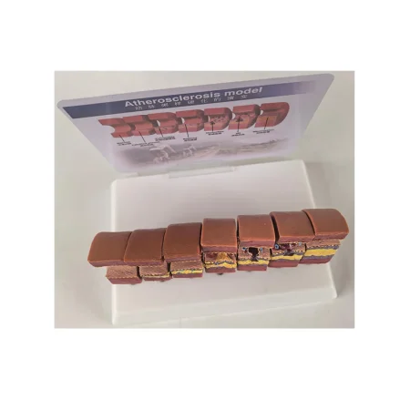 Realistic Artery Atherosclerosis Model 7-Segment | Lab & Medical Training Equipment