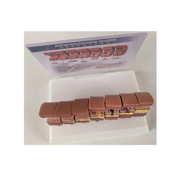 Realistic Artery Atherosclerosis Model 7-Segment | Lab & Medical Training Equipment