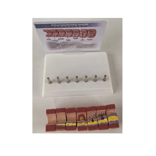 Realistic Artery Atherosclerosis Model 7-Segment | Lab & Medical Training Equipment