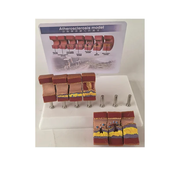 Realistic Artery Atherosclerosis Model 7-Segment | Lab & Medical Training Equipment