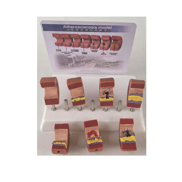 Realistic Artery Atherosclerosis Model 7-Segment | Lab & Medical Training Equipment