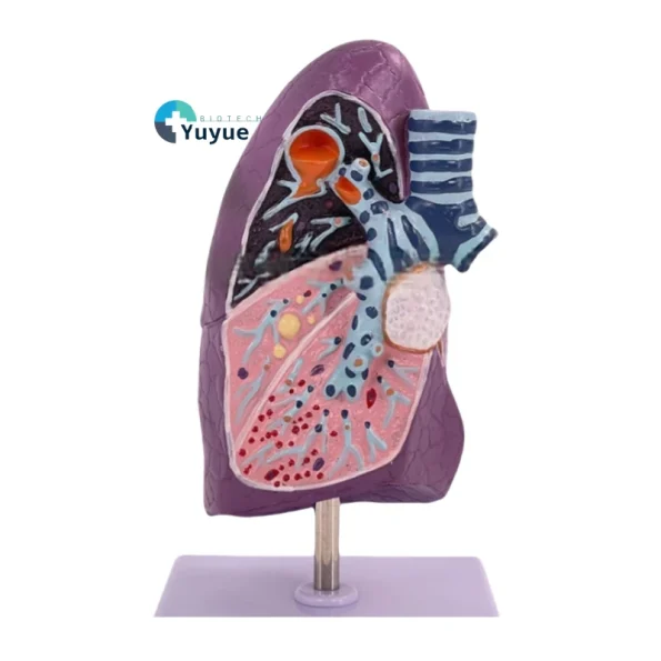 Smoker's Lung Cross-Section Anatomical Model PVC Human Trachea Lungs Anatomy Pathology Model for Internal Medicine Respiratory