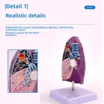 Smoker's Lung Cross-Section Anatomical Model PVC Human Trachea Lungs Anatomy Pathology Model for Internal Medicine Respiratory