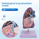 Smoker's Lung Cross-Section Anatomical Model PVC Human Trachea Lungs Anatomy Pathology Model for Internal Medicine Respiratory