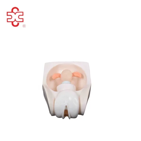 XC Brand Female Contraception Practice Model XC-417A PVC Material Medical School Teaching Use ISO Certified 23x17x14cm