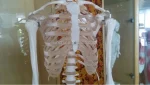 Xinch XC-101 180cm Tall Human Skeleton Models with Muscles and Ligaments Over 200 Bones for Medical Teaching & Training Use