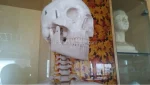 Xinch XC-101 180cm Tall Human Skeleton Models with Muscles and Ligaments Over 200 Bones for Medical Teaching & Training Use